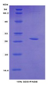 SDS-PAGE Top2b-8246M.jpg